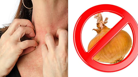 Food allergy rare cases