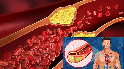 Cholesterol Ratio