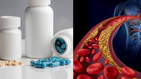 New Cholesterol Medicine