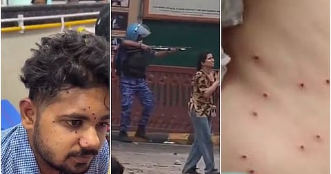 delhi-student-protest-pellet-injury-controversy