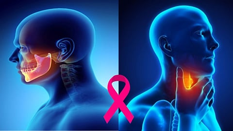 Head and neck cancer