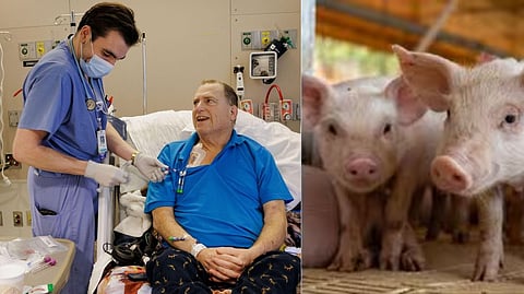 Pig-to-Human Kidney Transplant