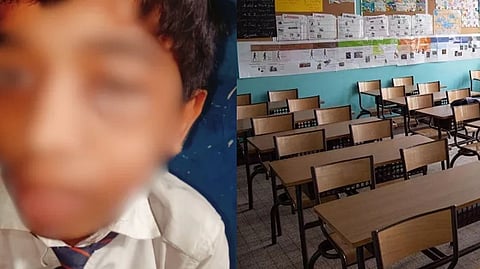 பள்ளியில் மாணவருக்கு நேர்ந்த அதிர்ச்சி சம்பவம்... கண்ணில் ரத்தக்கட்டு ஏற்படும் அளவுக்கு ஆசிரியர் தாக்கியதாக புகார்