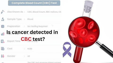 CBC report