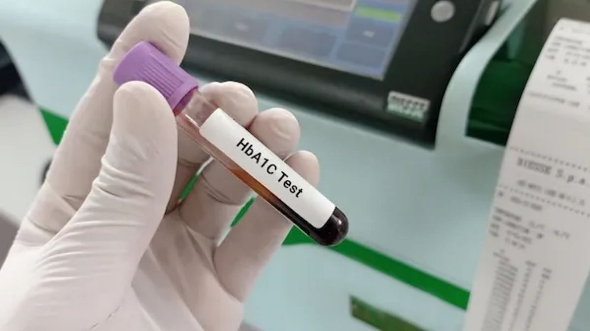 HbA1c பரிசோதனை: நீண்டகால சர்க்கரை கட்டுப்பாட்டின் துல்லிய அளவீடு