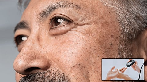 diabetic retinopathy