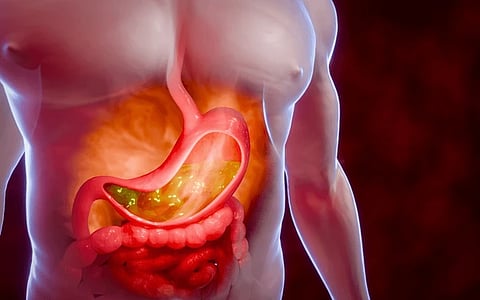 Foods to avoid with acid reflux
