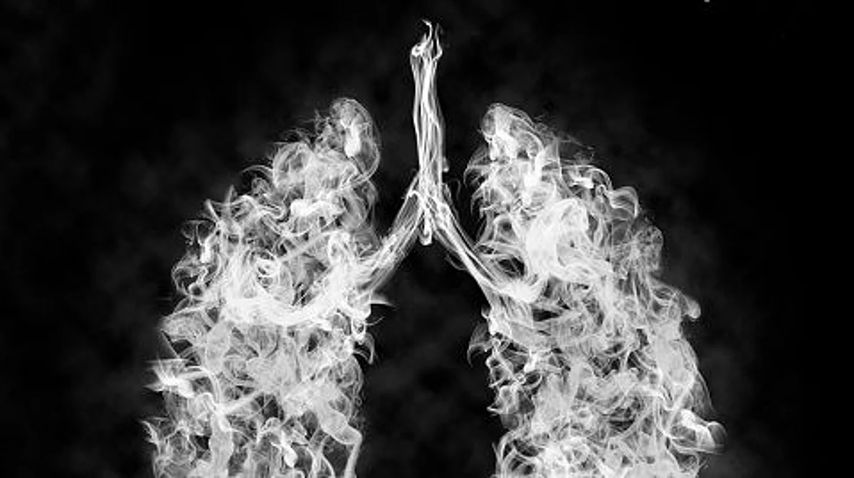 Manuka honey may help to clear drug-resistant lung infection (Pixabay)