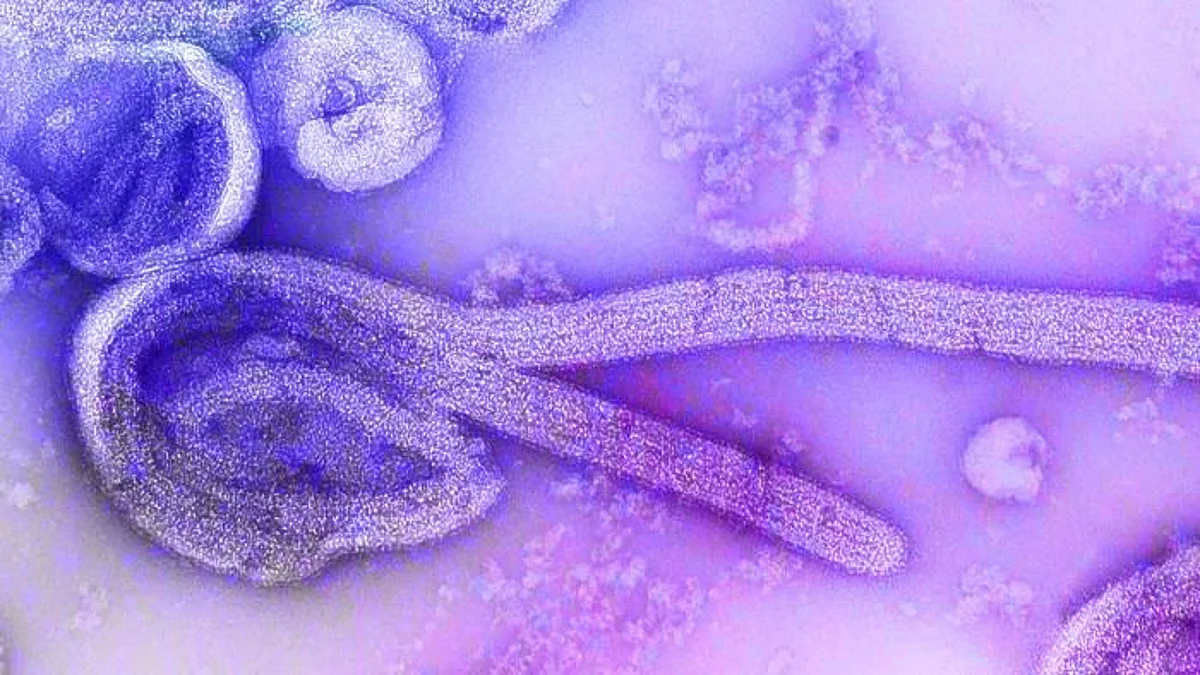 Seven confirmed cases amid Uganda's rare strain of Ebola virus (CDC PHIL)