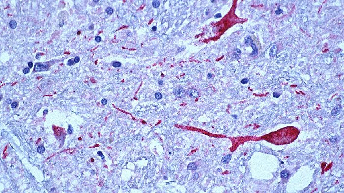 The scientists report that when they changed the rules of a task, a pair of regions on the brain’s surface, or cortex, collaborated to update and change the rats’ behavior to fit the new regime (representational image - CDC PHIL)