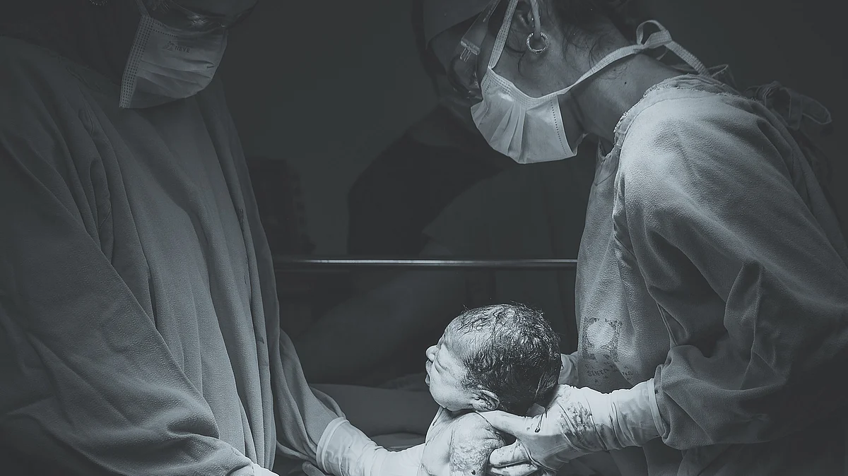 Crude and adjusted comparisons of cesarean delivery rates (representational image - Unsplash)
