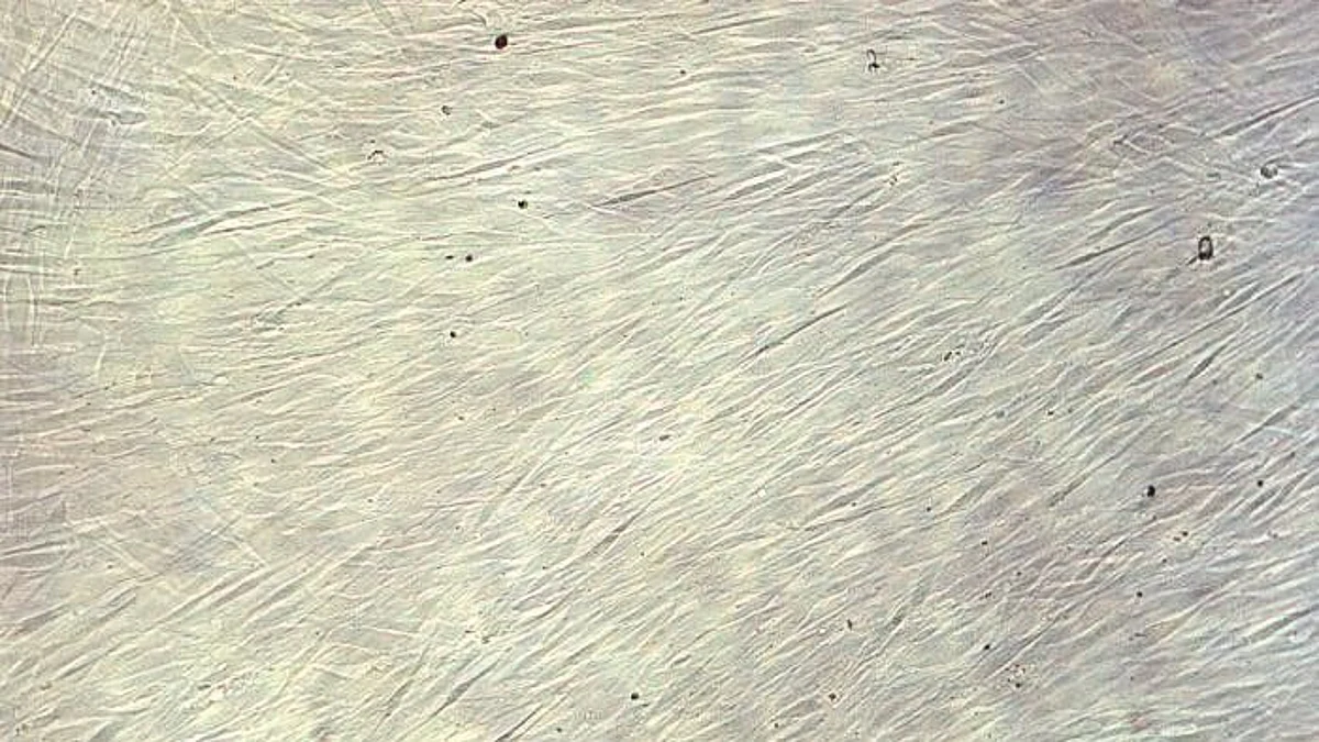 Study: Stem cells could aid repair of spinal cord damage (CDC PHIL)