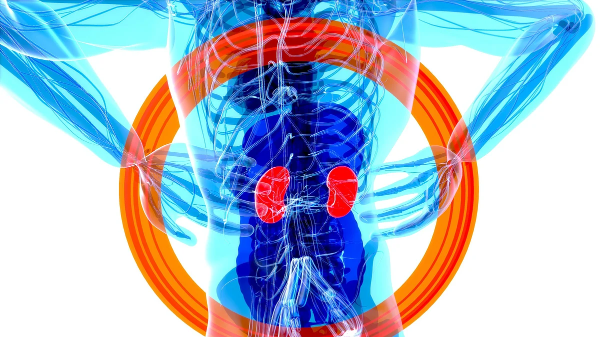 Leaving small kidney stones behind causes problems later (representational image - Unsplash)