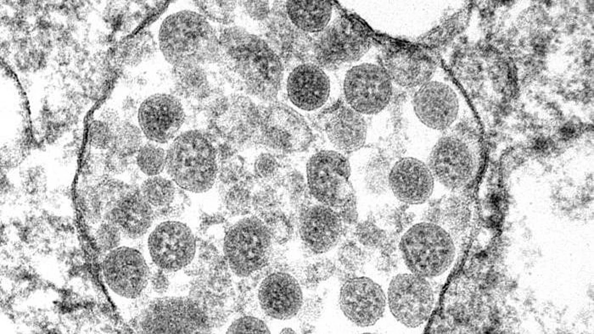 COVID-19 causes Life expectancy to drop for Native Americans (representational image - CDC PHIL)