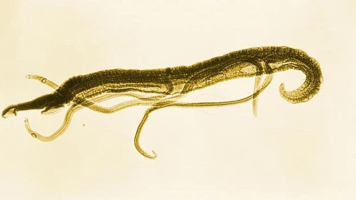 Not only Slugs, snails cause rat lungworm disease in humans (CDC PHIL)