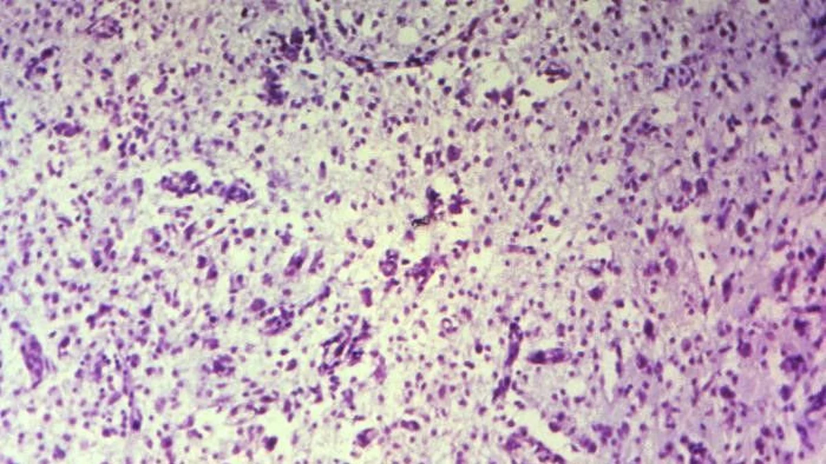 Cedars-Sinai Creates Computer Models of Brain Cells (representational image - CDC PHIL)