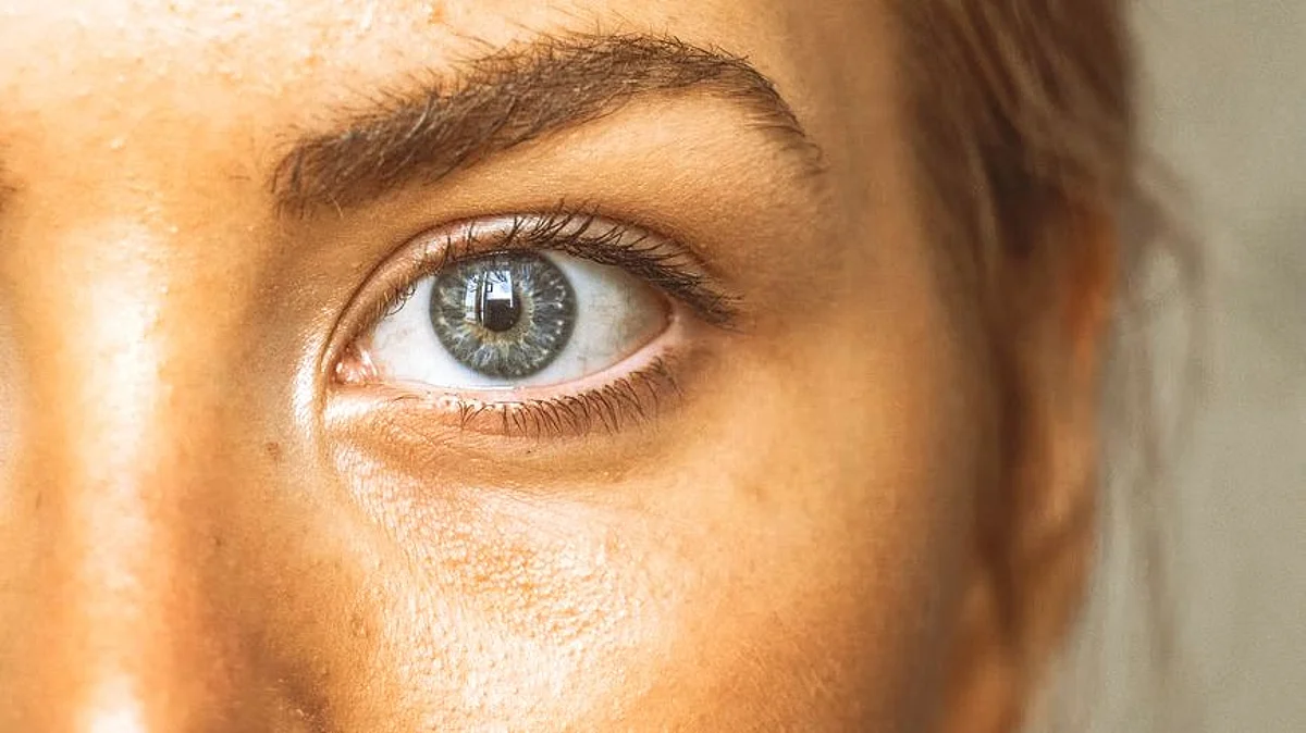 Use of new actives in skincare may lead to skin purging
(Unsplash)