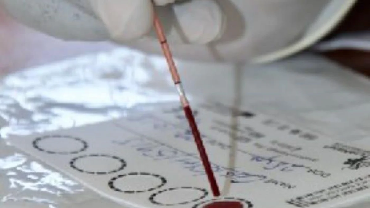 UP jails vulnerable to HIV spread (CDC PHIL)