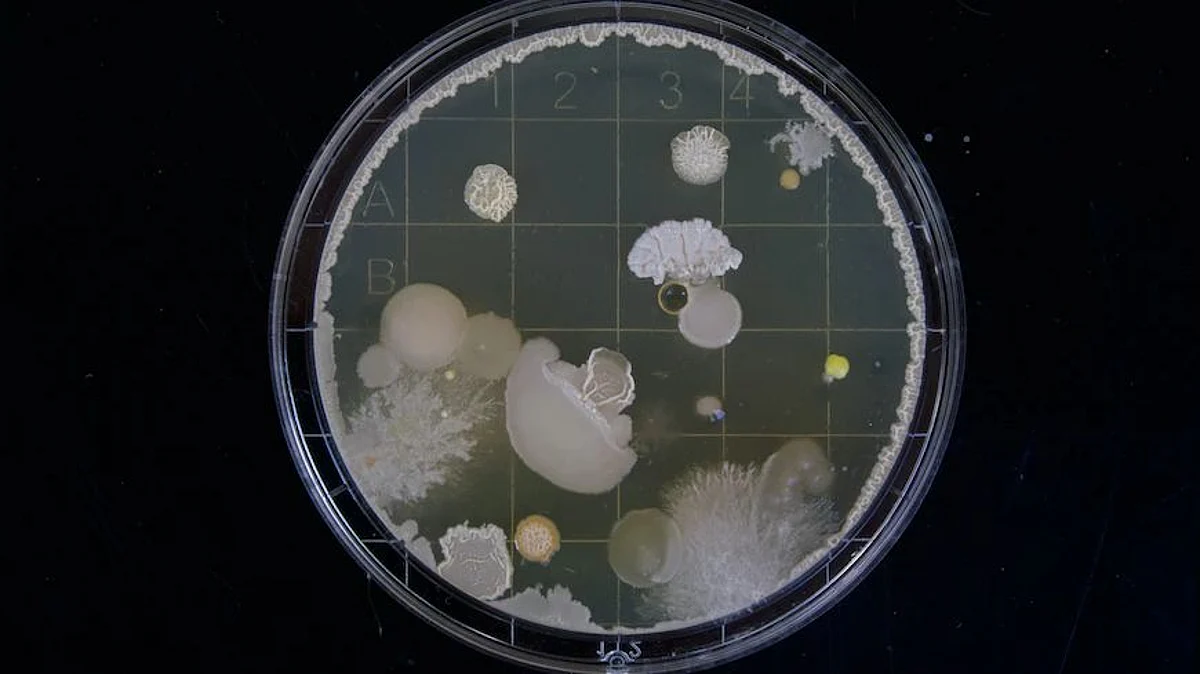 Using protein structures generated by an artificial intelligence program called AlphaFold, the researchers explored whether existing models could accurately predict the interactions between bacterial proteins and antibacterial compounds (Image Source- Unsplash)