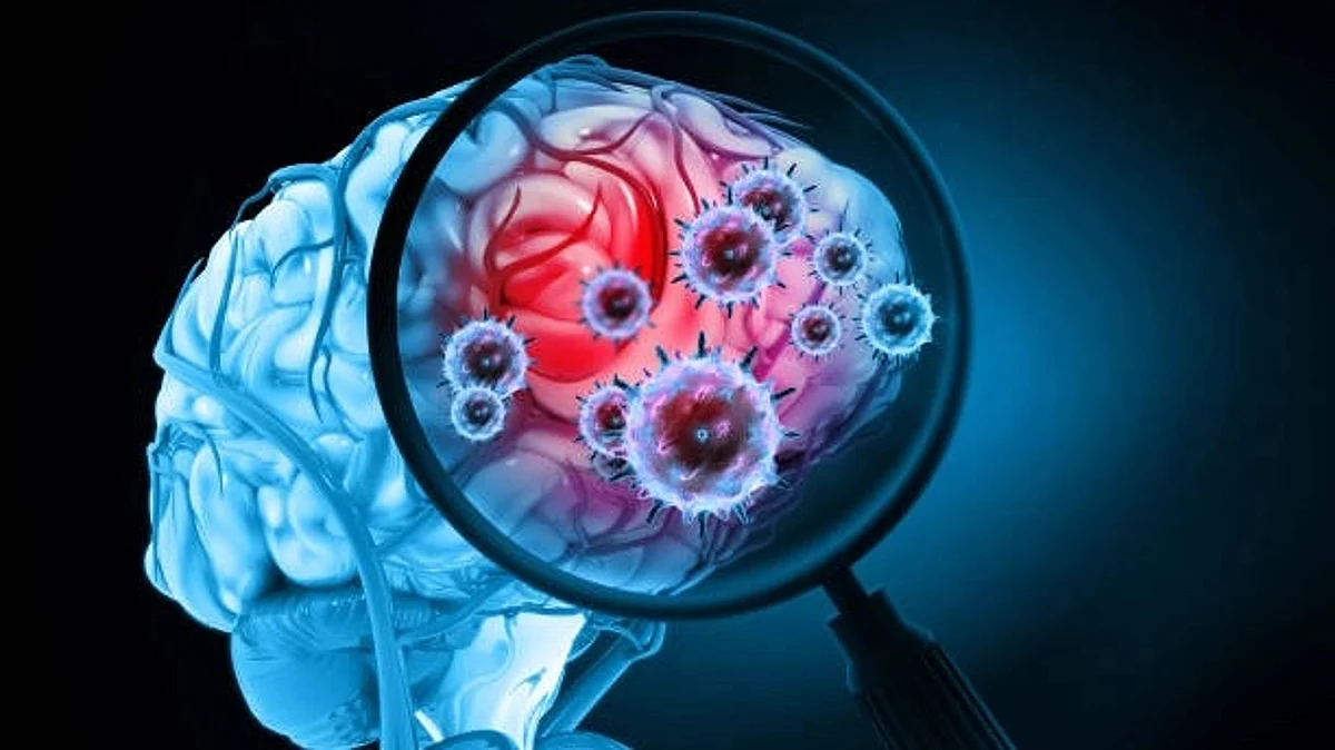 The researchers say there is not yet enough evidence to estimate neurological complication prevalence in the current outbreak (Unsplash)