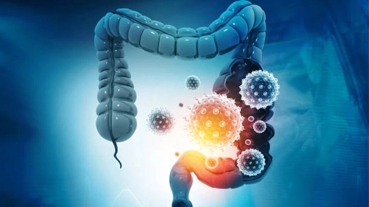 School of Medicine and MU Health Care have discovered how obstructive sleep apnea affects the gut microbiome (Unsplash)