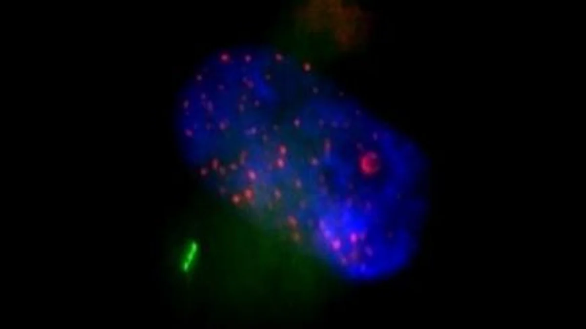 Primary cilium is an organelle protruding from the cell membrane that, like an antenna, collects signals from the extracellular space and transduces information into cells.