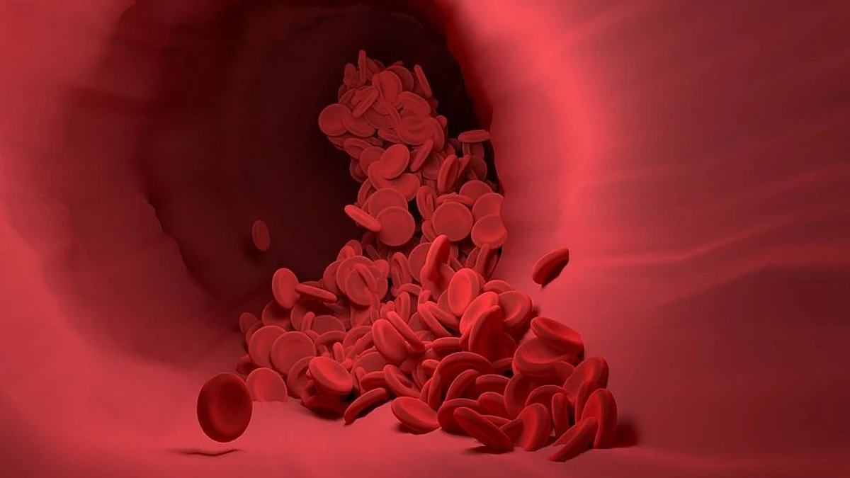 Aortic regurgitation results from the blood from the aorta flowing back into the left ventricle during the diastolic phase of the heart's activity (Pixabay)