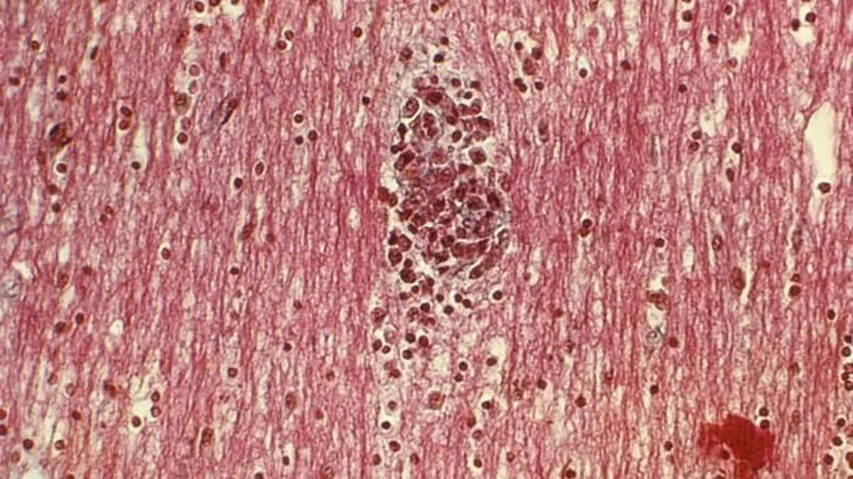 Microglia are a type of immune cell that works as a ‘janitor’ to the central nervous system that clears out dead cells and other debris. But when these janitor cells themselves die, other microglia don’t do the cleaning up of their fallen brethren. So who does? Researchers have now identified the janitors of these janitors, helping explain how the nervous system maintains optimal conditions for functioning.