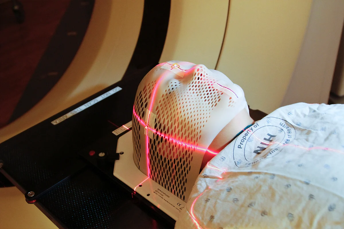 Radiation-hormone therapy combination may slow the growth of oligometastatic prostate cancer.