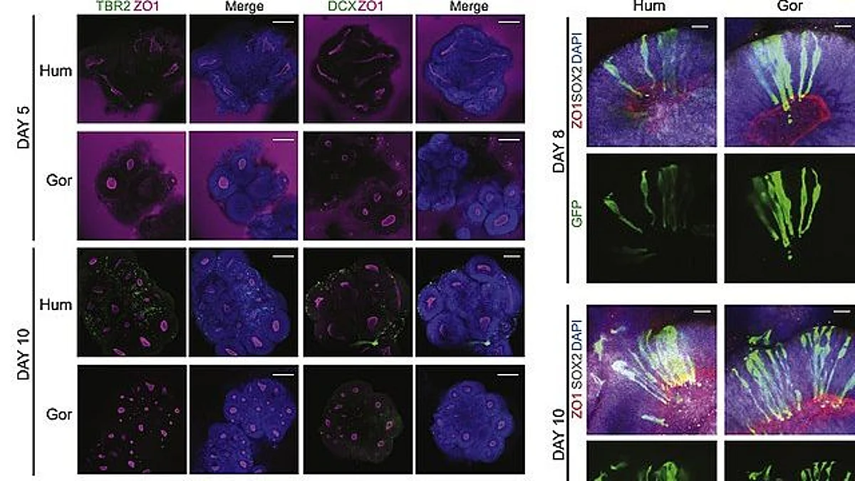 Researchers at Linköping University have identified in mice the cells in the blood vessels of the brain that are necessary for a fever reaction.