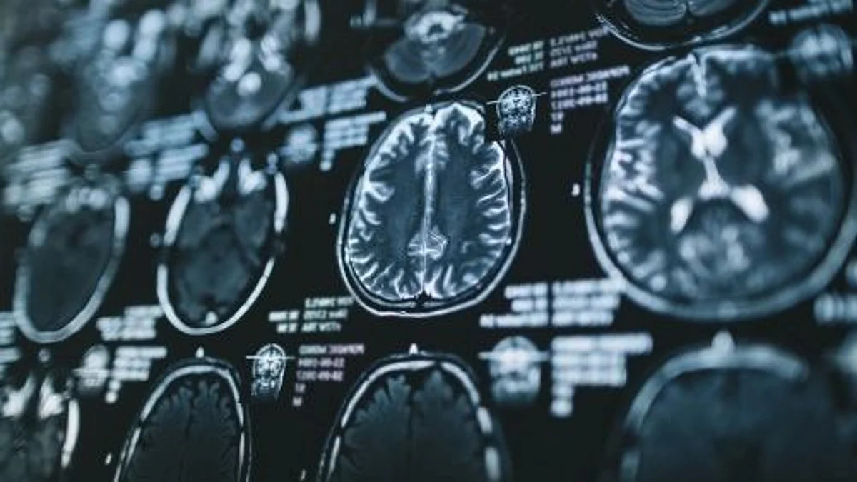 New research by Cedars-Sinai investigators supports evidence that social factors, such as unemployment, financial difficulties, racial discrimination and other stressors, affect an individual's health.