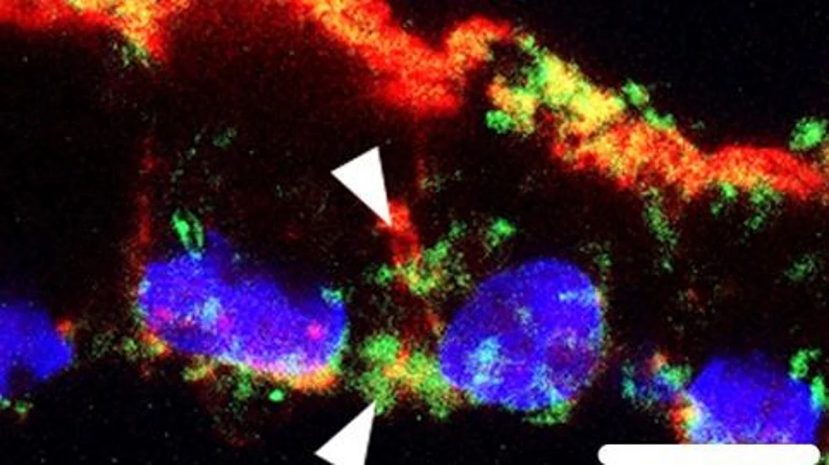 A cross section of the stem-cell generated RPE is shown after it has been fed photoreceptor outer segments. Arrows point to lipid deposits (green). This buildup of lipids is toxic to the cell, and similar to that seen in patients with Stargardt disease.