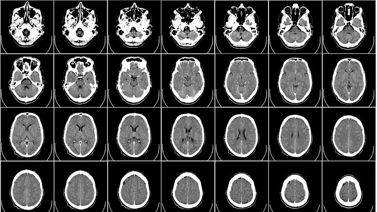The database, called neuromaps, will help scientists find correlations between patterns across different brain regions, spatial scales, modalities and brain functions (Wikimedia commons)