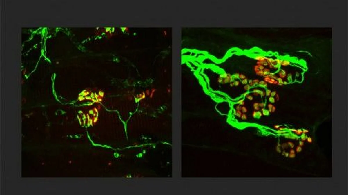 Researchers at Washington University School of Medicine in St. Louis are working toward a treatment for neurodegenerative diseases that targets SARM1, a key molecule in the death of axons, the wiring of the nervous system. Shown, the axons (green) are thinner in a rodent model of an inherited axonal peripheral neuropathy (left). When SARM1 is missing from rodents with the disorder, the axons are thicker (right) and indistinguishable from normal, healthy axons. Finding ways to block SARM1 could lead to new therapies for a broad range of neurodegenerative diseases.