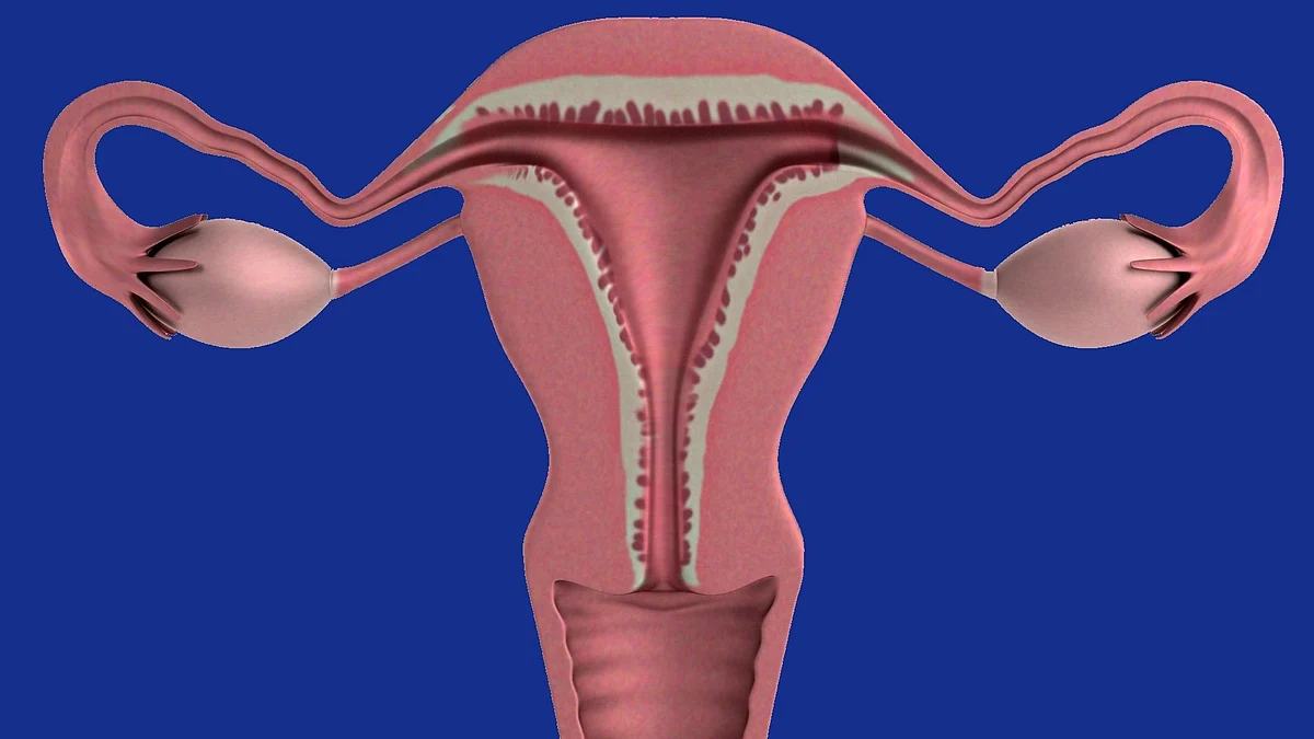 Polycystic ovary syndrome (PCOS) is a complex hormonal condition that affects 1 in 10 women of childbearing age. (Image: Pixabay)