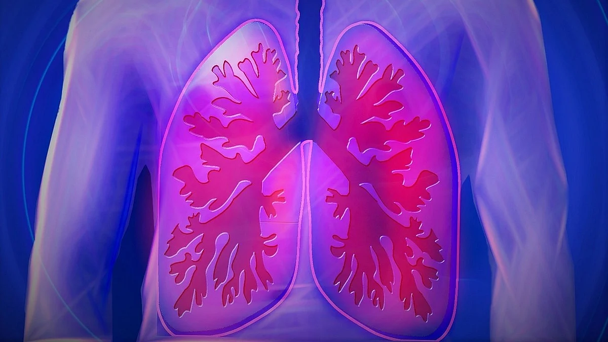Scientists Clarify Causes of Asthma and Find a Potential Therapy.(Image : Pixabay)