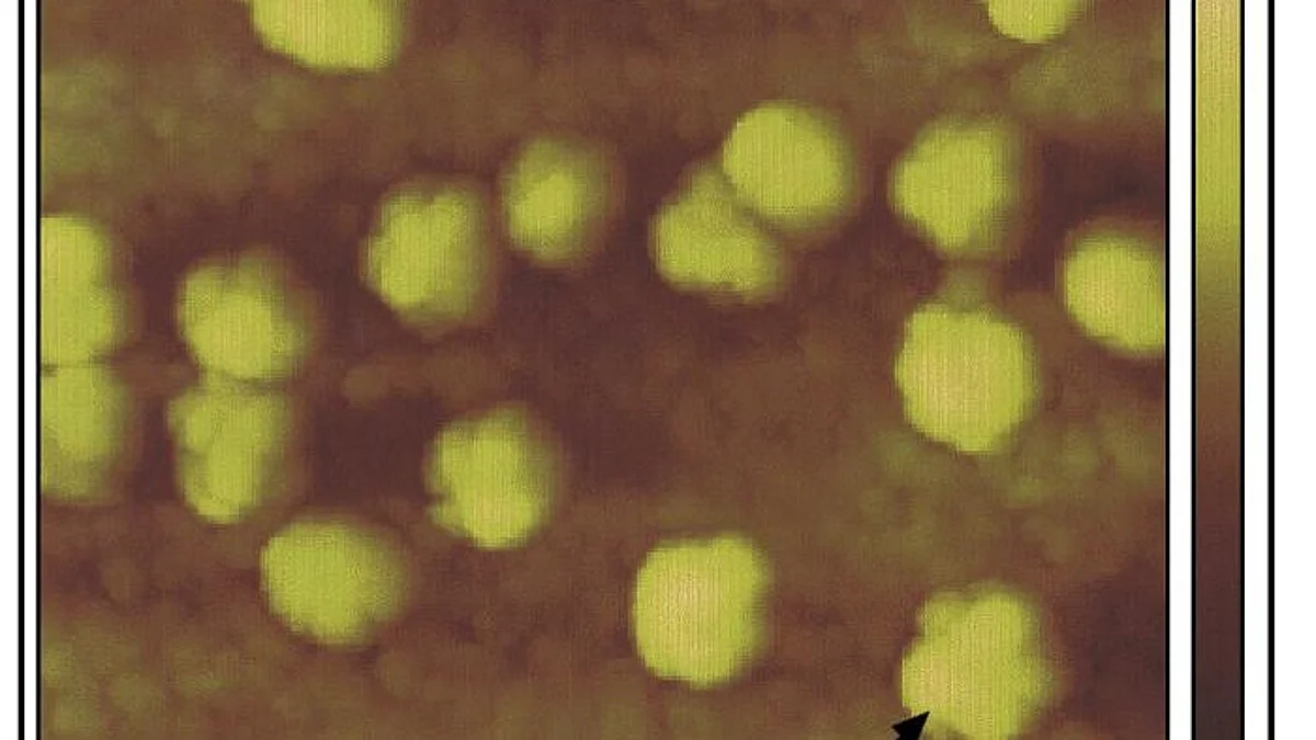 A team of researchers has developed a nanotechnology platform that can change the way the immune system sees solid tumor cells, making them more receptive to immunotherapy. (CDC PHIL)