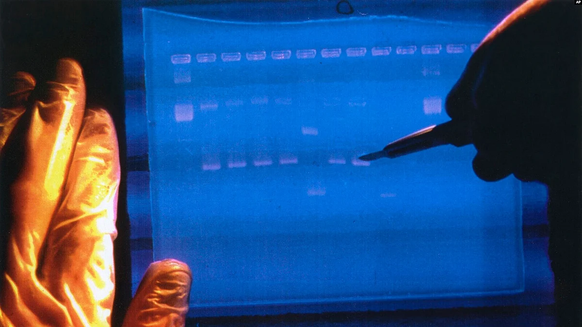 A genetic test known as chromosomal microarray analysis (CMA) could help identify the cause of sudden infant death syndrome (SIDS) or its counterpart in older children, known as sudden unexplained death in childhood (SUDC).