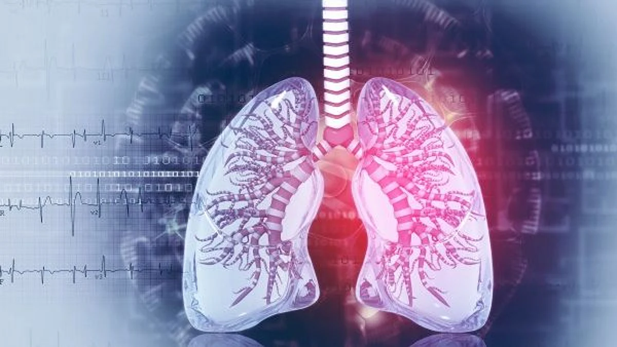 If lung cancer is found at an earlier stage, when it is small and before it has spread, it is more likely to be treated successfully. (Image: Newswise)