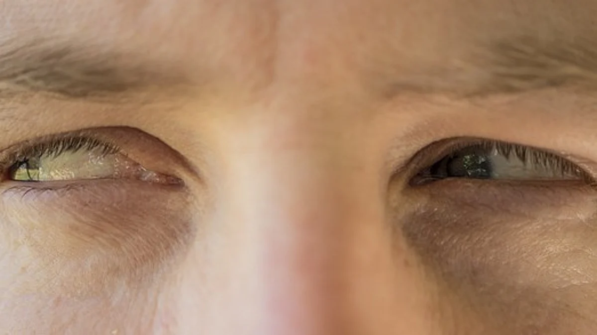 The investigators found that during eye contact, participants with ASD had significantly reduced activity in a brain region called the dorsal parietal cortex compared to those without ASD. (Image: Pixabay)