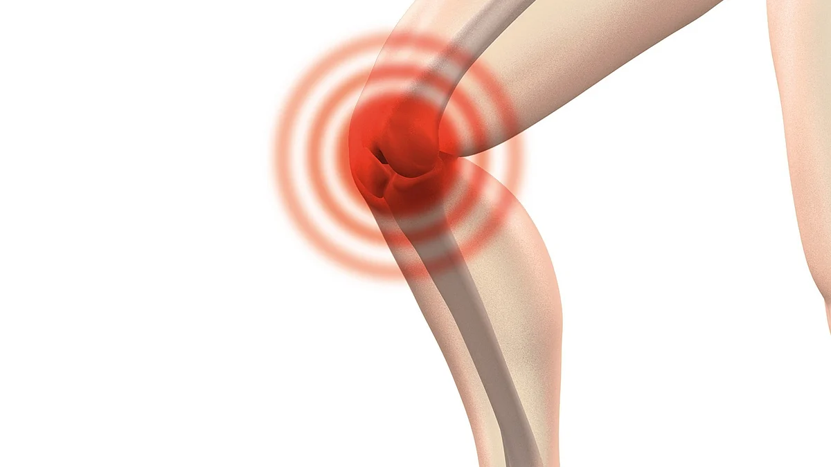 Synovial tissue lines the knee joint and produces fluid that helps the joint move. It can become inflamed as osteoarthritis progresses.(Image : Pixabay)