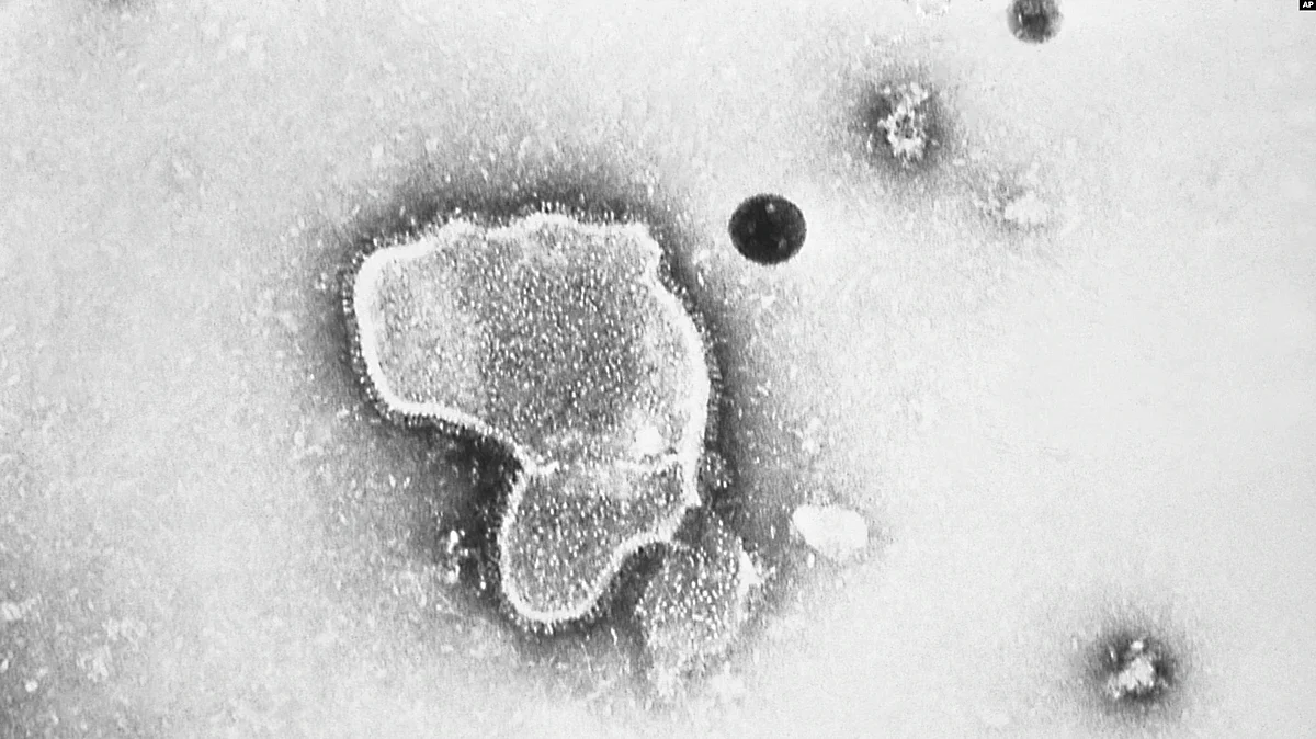 The preliminary results buoy hope that after decades of failure and frustration, vaccines against RSV may finally be getting close. (Image: VOA)