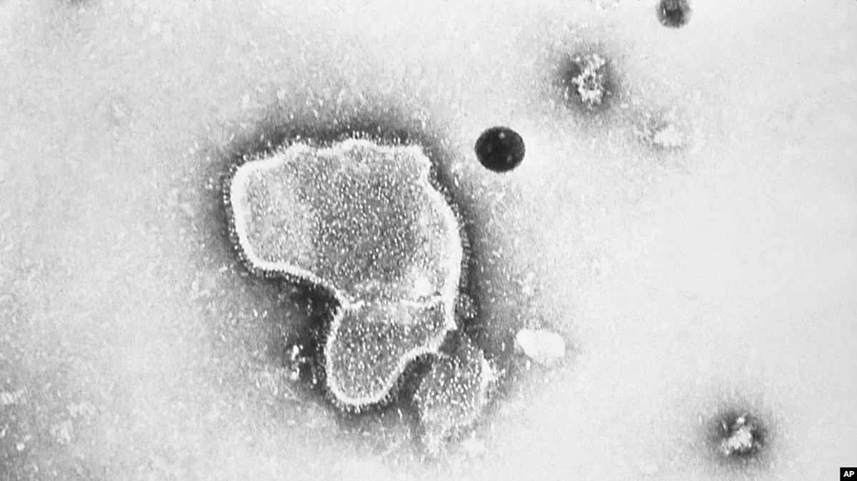 Pneumonia is a serious, potentially life-threatening lung infection that can strike both children and adults. It is the single biggest infectious killer of adults and children, with an annual mortality rate of roughly 2.5 million adults and children globally.