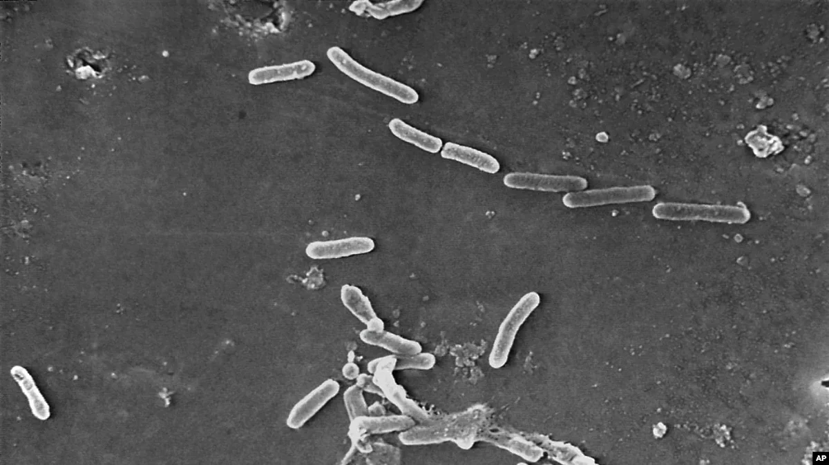 This scanning electron microscope image shows rod-shaped Pseudomonas aeruginosa bacteria.