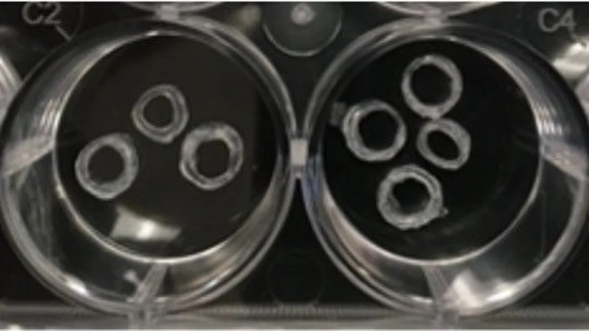 Novel hydrogel scaffolds developed by the UB researchers containing various concentrations of strontium.