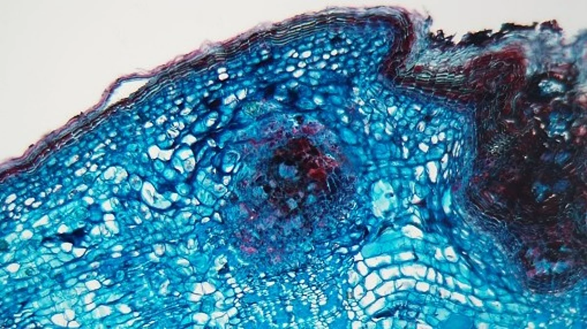 Researchers discovered that a new generation of precision therapeutics against infection, cancer, and autoimmune disease is driven by memory T cells in the gut