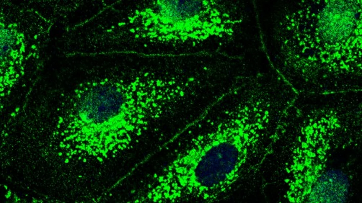 Fluorescence microscope image of cells in the lung’s blood vessels. The study has shown for the first time that these cells possess a CFTR chloride channel (green), and that lung inflammation-induced loss of this channel results in increased permeability of pulmonary vessels. Cell nuclei appear as round dark spots, and cell membranes appear as fine lines.