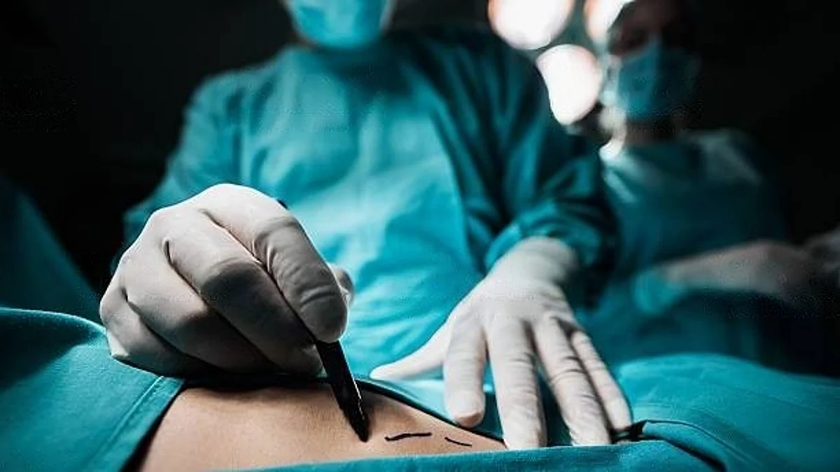 Nearly one-fourth of breast cancer patients who start breast reconstruction after mastectomy don't complete the reconstructive process. (Unsplash)