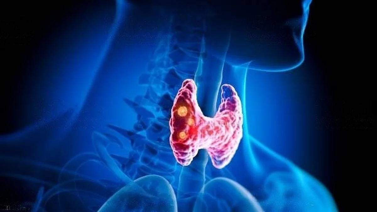 Experts provide framework for treating a common and life-threatening metabolic complication of cancer known as hypercalcemia of malignancy in the Endocrine Society’s new Clinical Practice Guideline.(Unsplash)