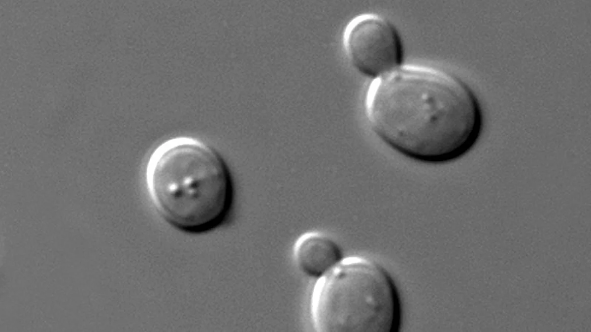 Saccharomyces cerevisiae cells in DIC microscopy. Wikimedia Commons.